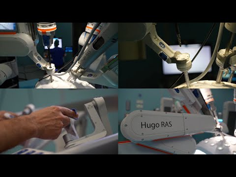 All’ospedale Miulli arriva Hugo, il nuovo sistema di chirurgia robot-assistita
